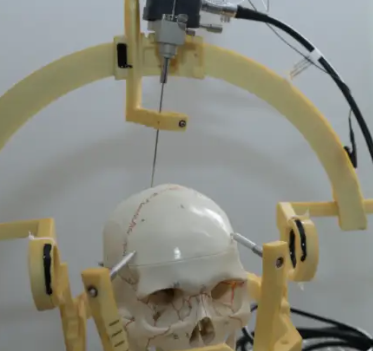 首款侵入式脑机接口医疗器械获批上市